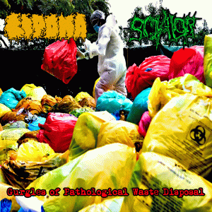 Lipoma : Gurgles of Pathological Waste Disposal